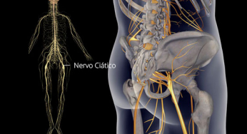 Nervo ciático: quem é ele?