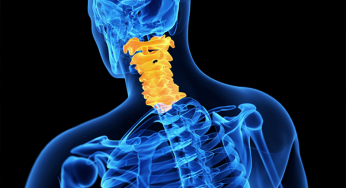 Principais cirurgias da coluna cervical