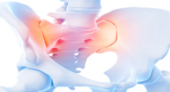 Sacroileíte: inflamação da articulação sacroilíaca