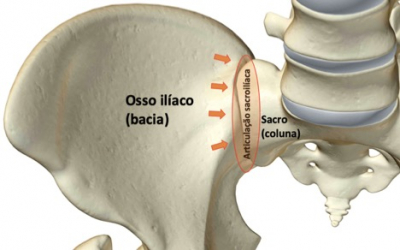 Esquema da articulação sacroilíaca.