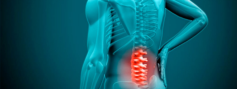 Quanto tempo de repouso é necessário após uma cirurgia de hérnia