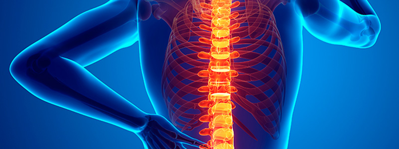 Problemas na coluna vertebral: cuidado com movimentos ao arrumar a