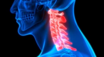 Cervicalgia – Dor na região do pescoço