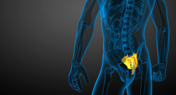Inflamação no cóccix: coccigodínia ou coccidínia