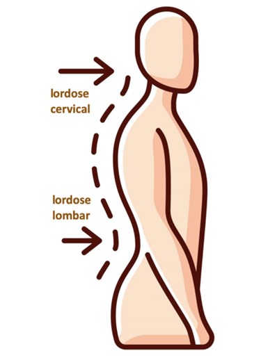 Desenho de coluna vertebral vista de lado. A seta de cima representa a lordose cervical e a de baixo, lordose lombar.