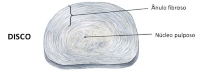 O disco intervertebral é composto por núcleo pulposo e ânulo fibroso. O ânulo fibroso é a parte externa do disco e o núcleo pulposo do disco intervertebral, a interna.