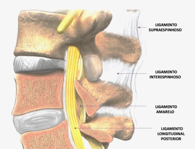 Imagem de ligamentos importantes na região da coluna lombar